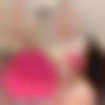 Βούρτσα μασάζ καθαρισμού προσώπου | STARGLO